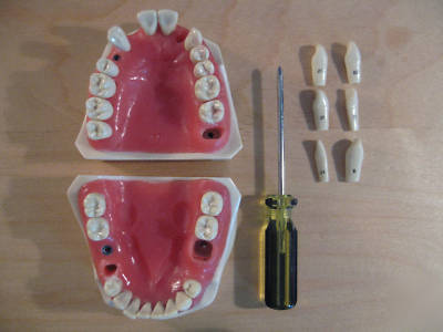 Columbia dentoform corp typodont modelÂ R861 R862 dental