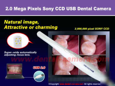 2.0MP high resolution sony ccd dental intraoral camera