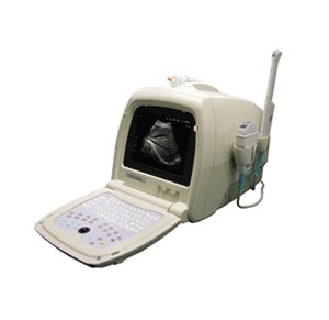 New portable convex ultrasound scanner CMS600A 