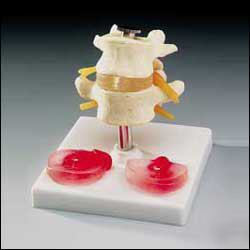 Lumbar spine vertebrae anatomical model chiropractic 