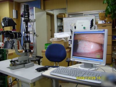 Export slit lamp image to digital camera and computer