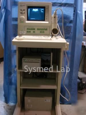 Aloka ssd-500 portable ultrasound w/ transducer