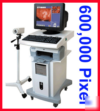 New brand digital video electronic colposcope+software