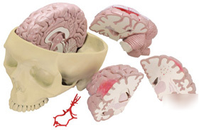 New anatomical brain & partial skull cranium model