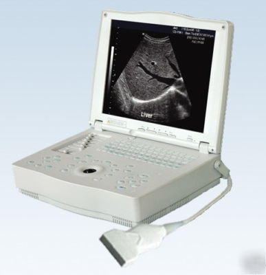Laptop ultrasound scanner 7.5MHZ linear + convex probes