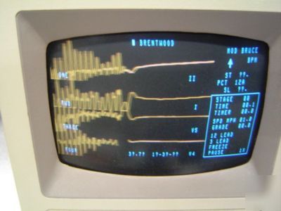 Brentwood stress test system monitor and cable