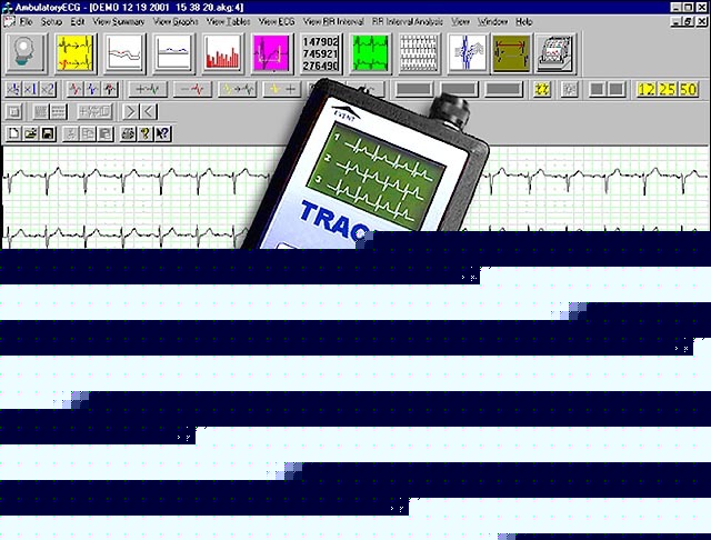 Medata holter ecg analysis system with 2 recorders