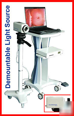 New brand digital video electronic colposcope