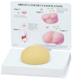 New anatomical breast cancer demonstration model