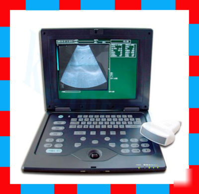 New digital ultrasound scanner ultrasoundmachine+convex